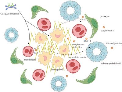 Molecular insight in intrarenal inflammation affecting four main types of cells in nephrons in IgA nephropathy